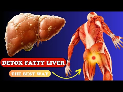 The BEST Food to DETOX Fatty Liver Naturally | Health care
