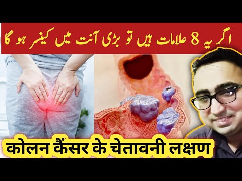 8 Early Warning Signs Of Colon Cancer You Should Not Ignore