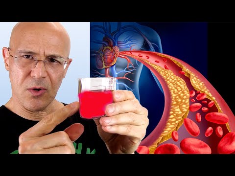 1 Shot…Opens Arteries Fast and a Lot (Prevent Heart Attack & Stroke) | Dr. Mandell