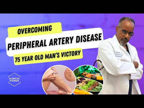 From Struggle to Victory Over Peripheral Artery Disease: A Health Makeover at 75