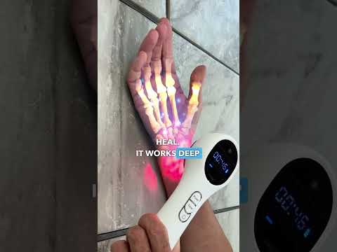 Do this to end neuropathy #health #healthy #neuropathy #wellness