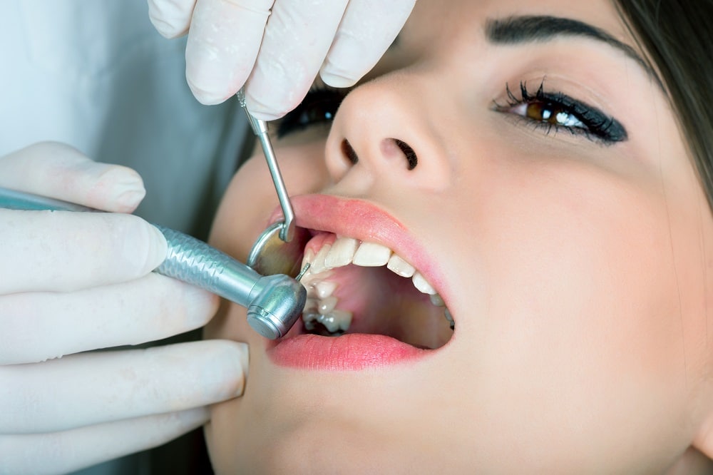 Protect Your Health During Dental Amalgam Removal